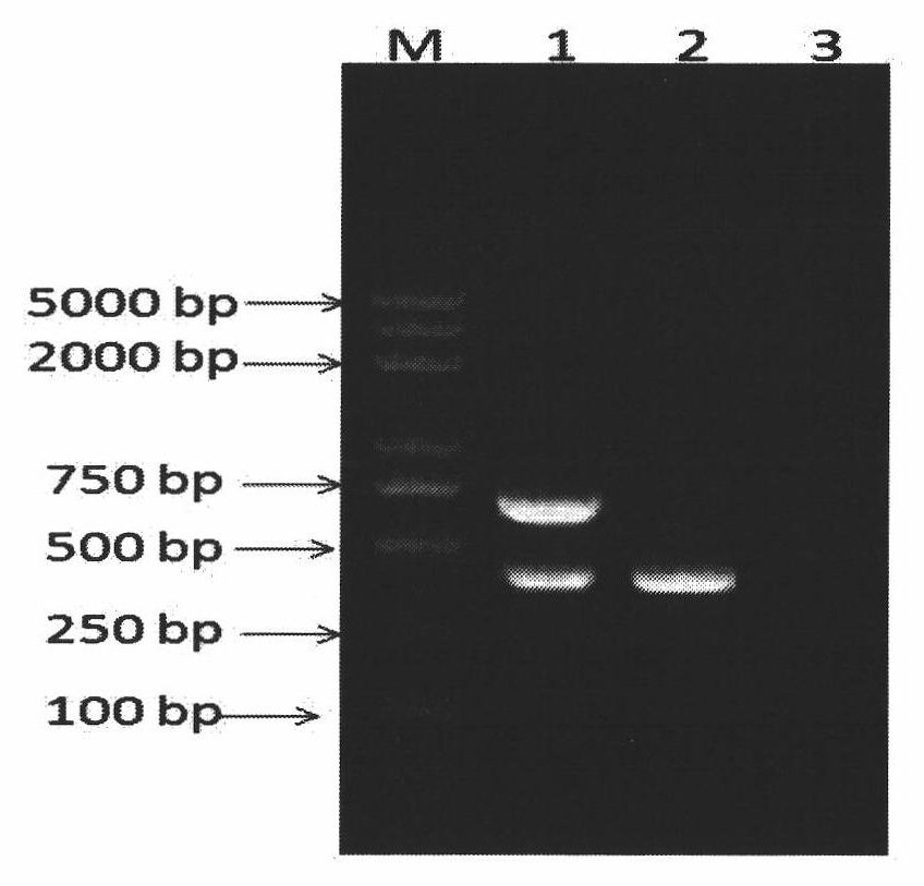 Kit for simultaneously detecting classical strains and variant strains of porcine reproductive and respiratory syndrome virus and detection method thereof