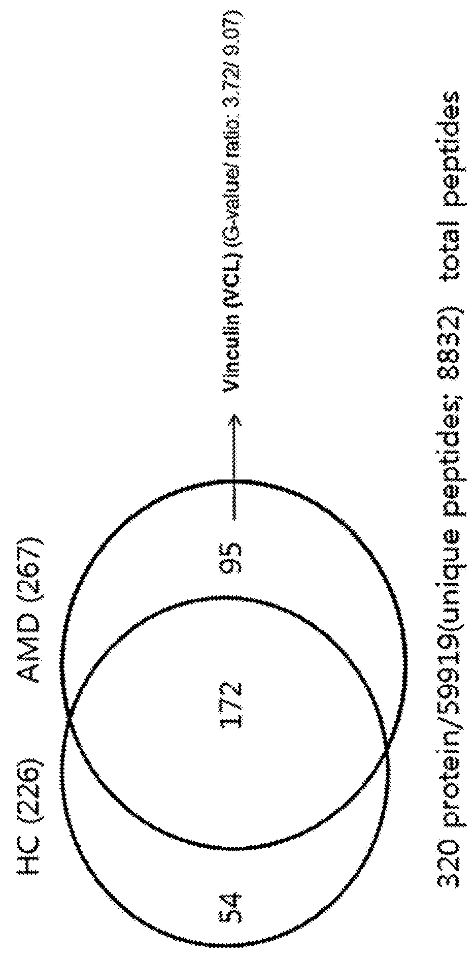 Marker for diagnosing age-related macular degeneration, and method for diagnosing age-related macular degeneration by using same