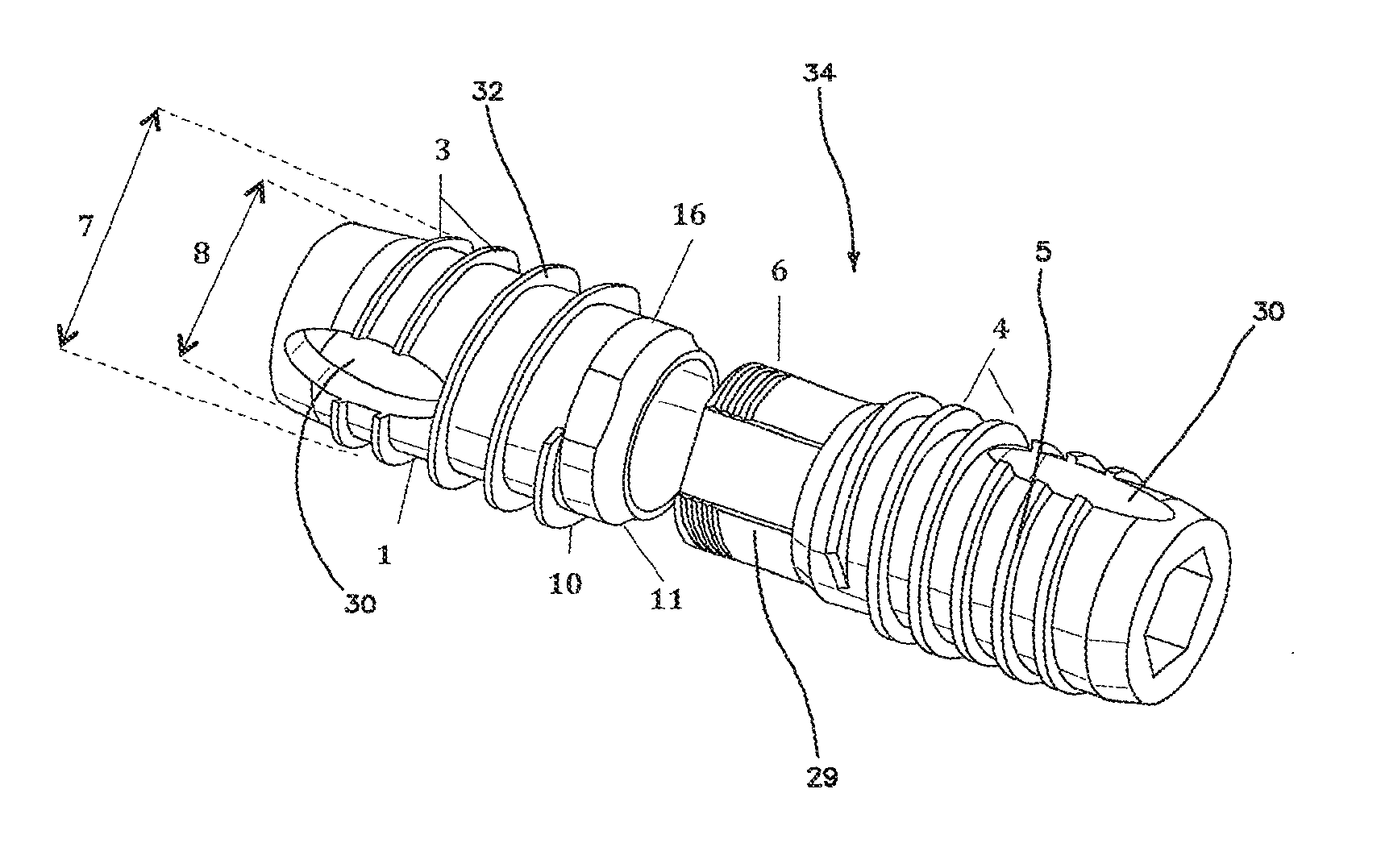 Apparatus and method for use in the treatment of hammertoe