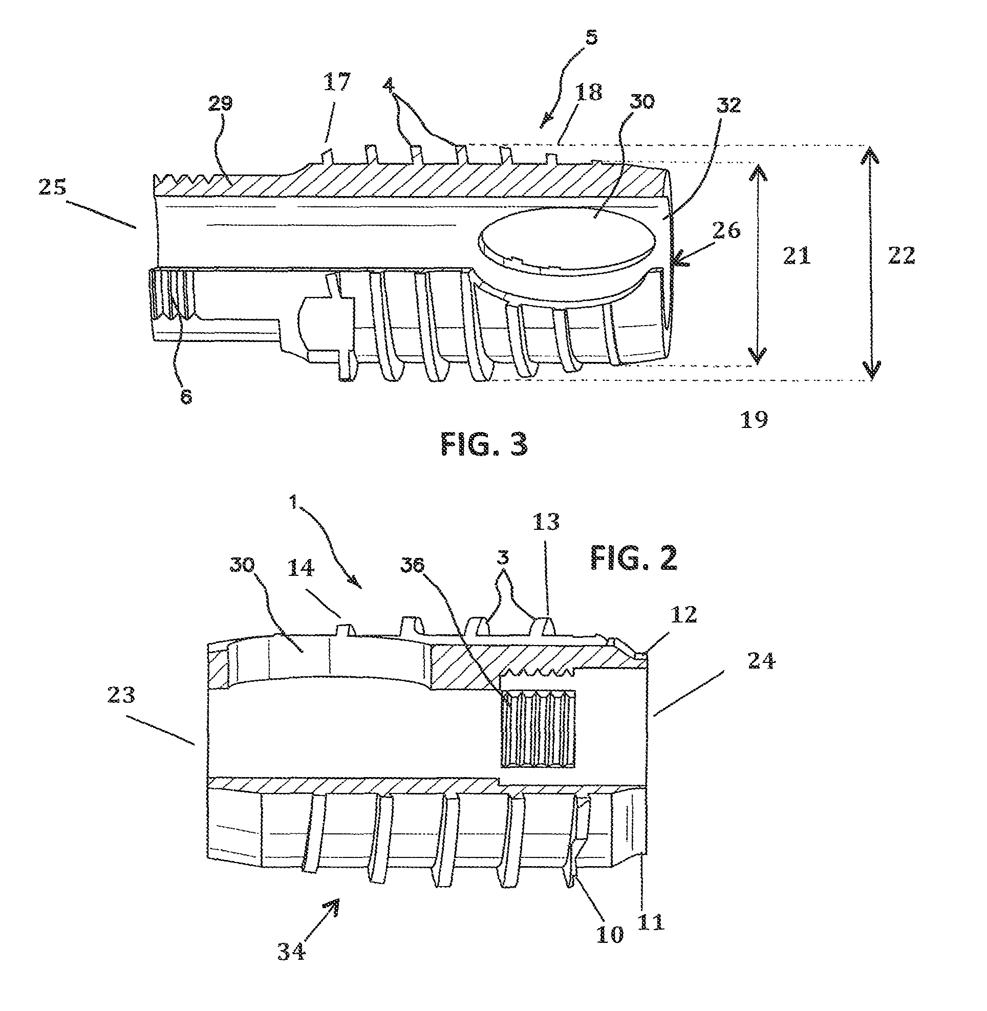 Apparatus and method for use in the treatment of hammertoe