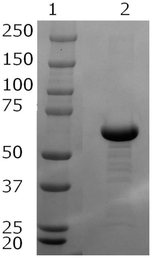 A SARS-CoV-2 virus S protein receptor binding region encoding gene, antibody and application