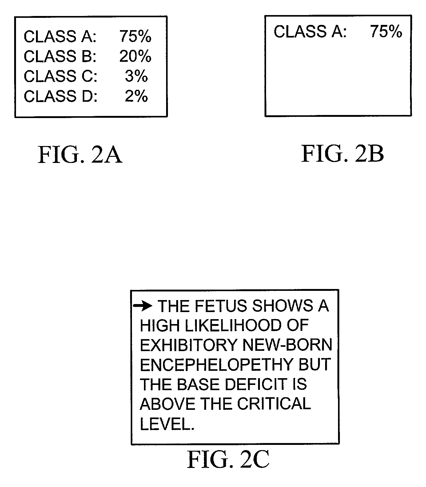 Method and apparatus for monitoring the condition of a fetus