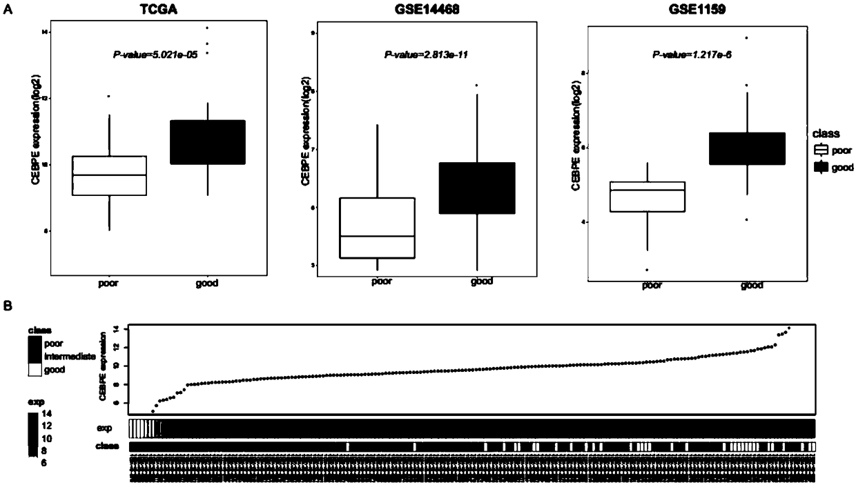 Genetic marker for risk assessment on AML (acute myelogenous leukemia) and application of genetic marker