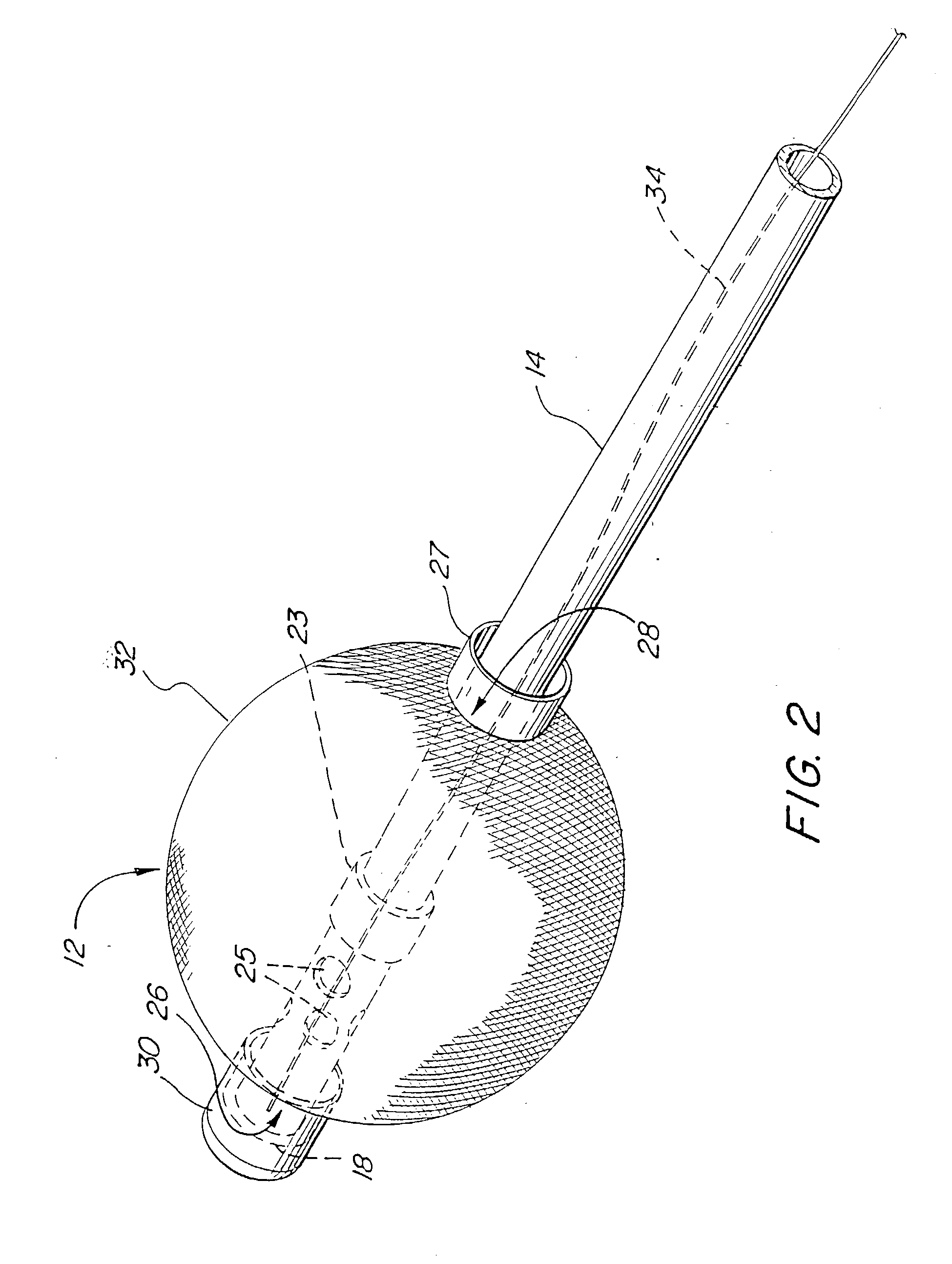 Self-deploying catheter assembly