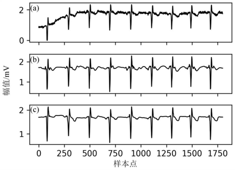 ECG denoising method based on EEMD-Hilbert transformation