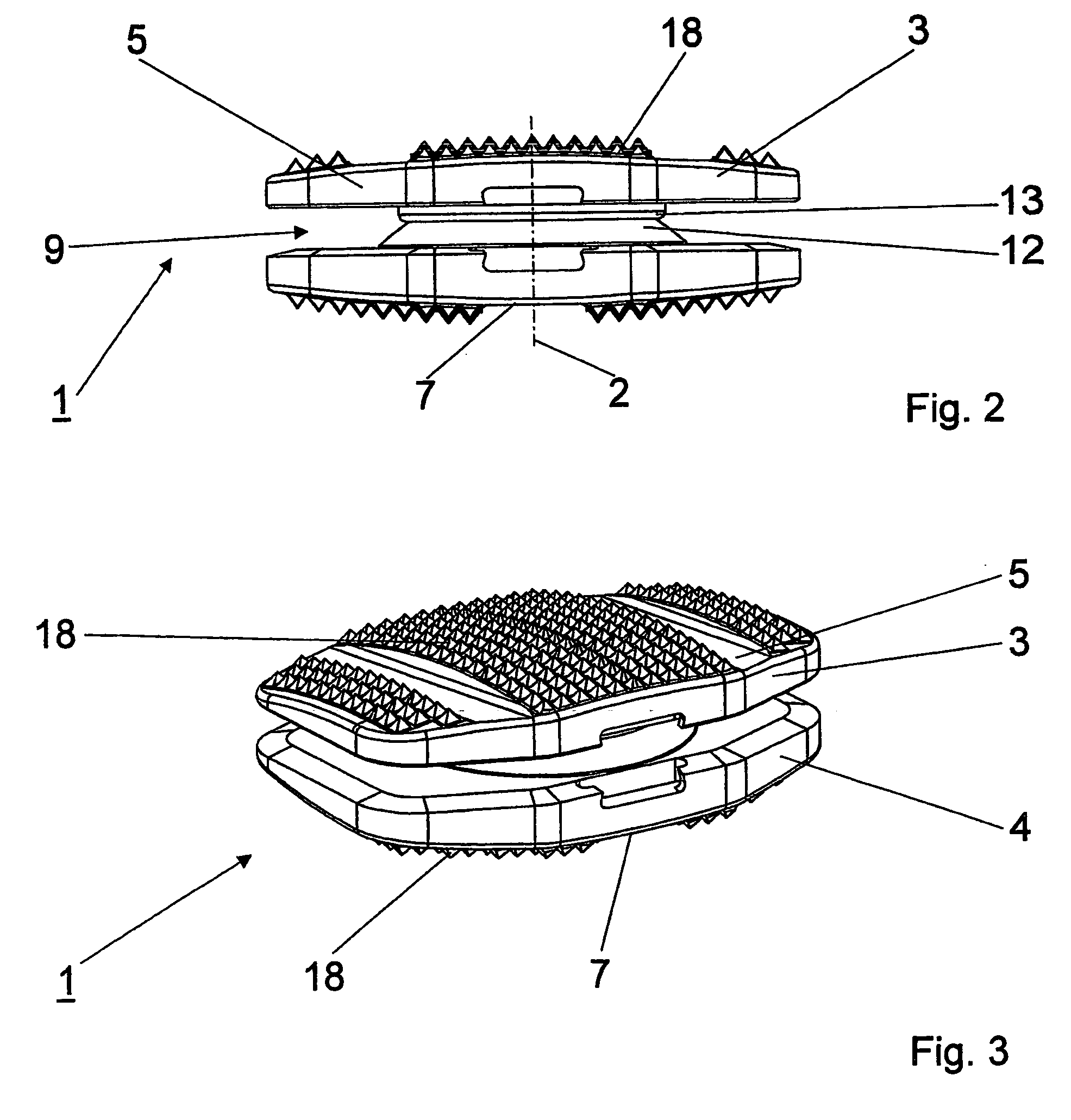 Intervertebral implant comprising dome-shaped joint surfaces