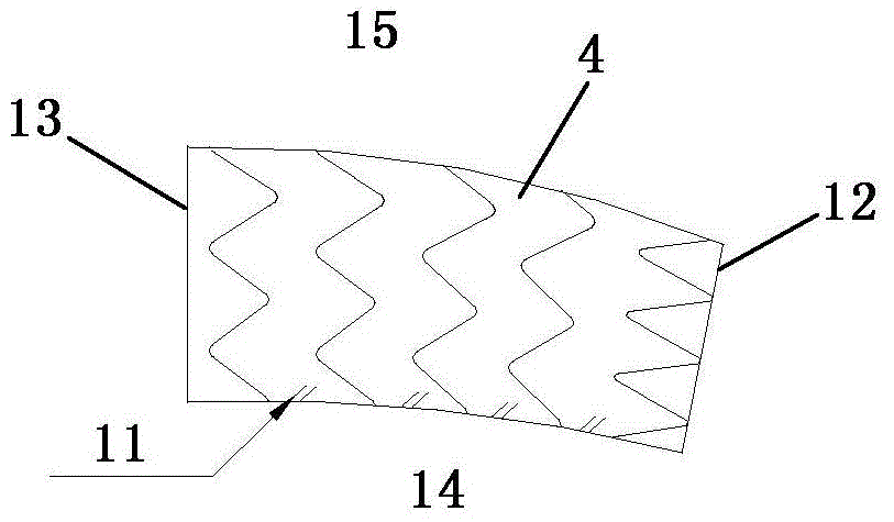 Intra-operative stent system