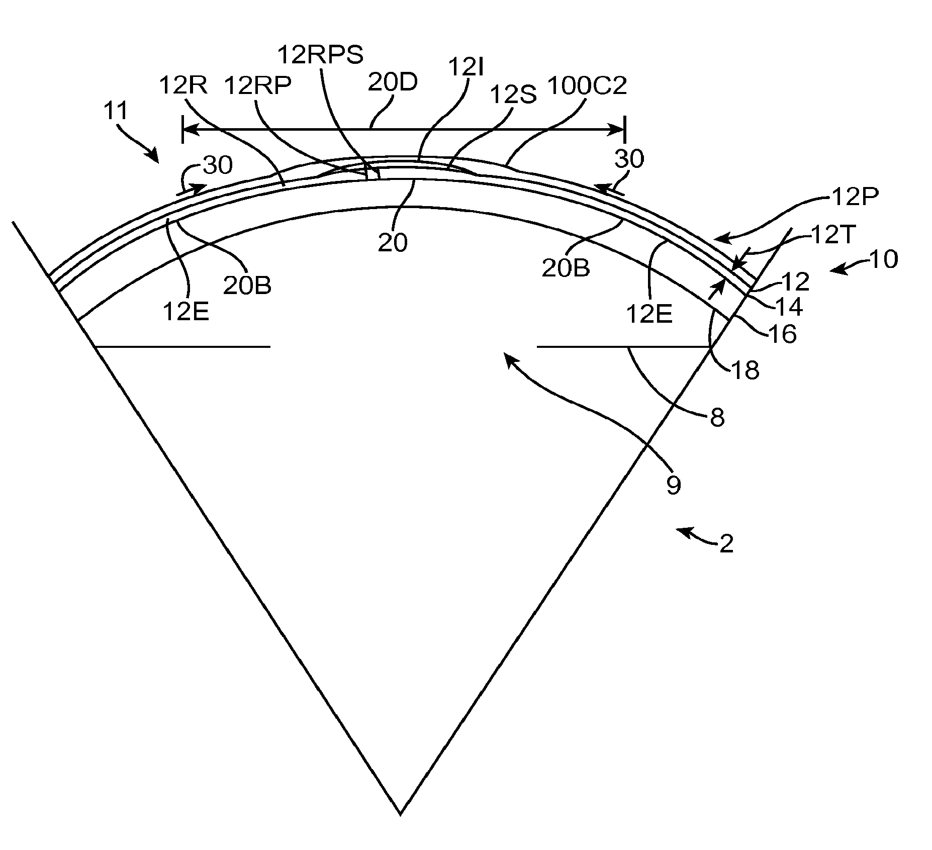 Conformable Therapeutic Shield for Vision and Pain