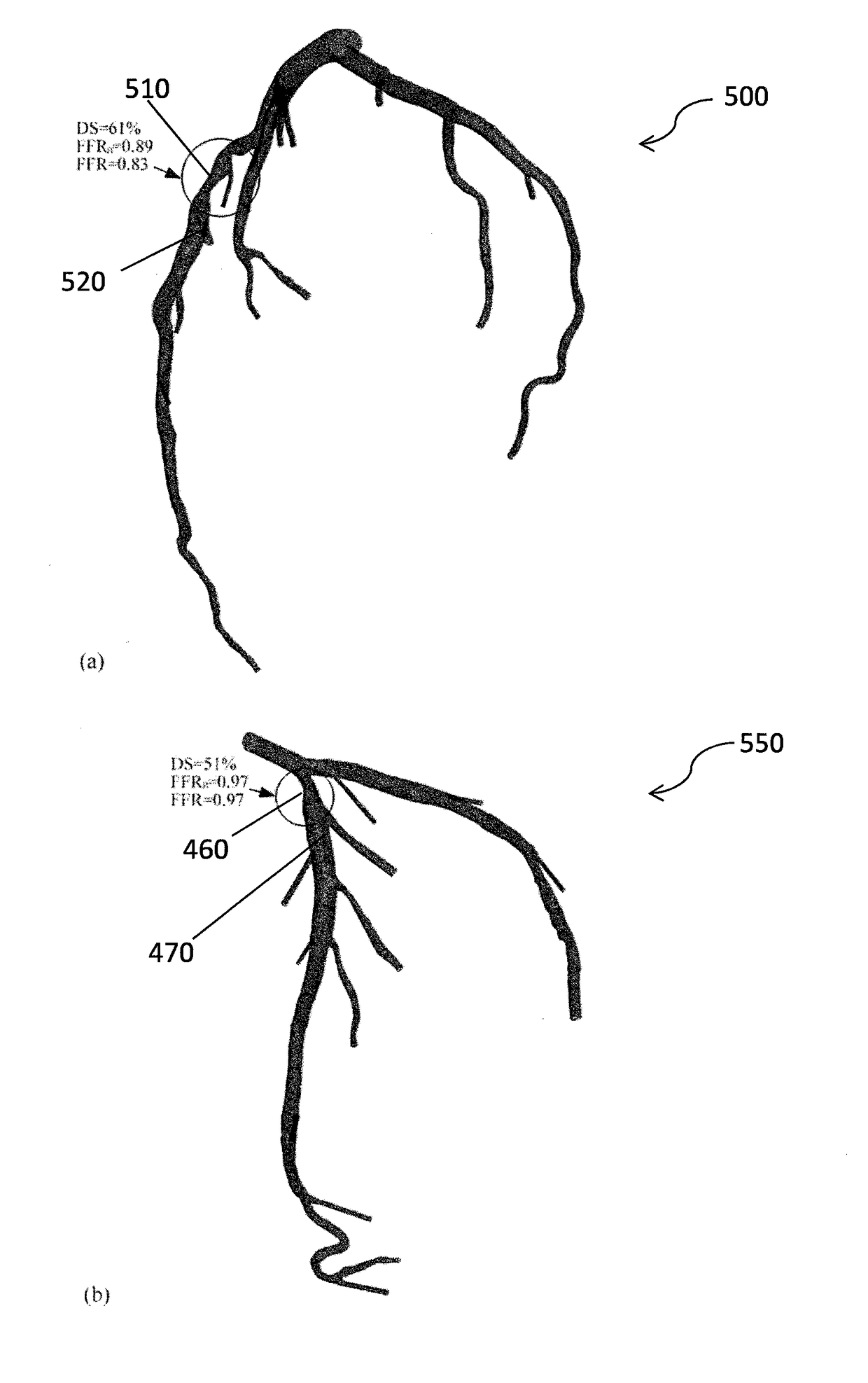 Medical image processing methods and systems