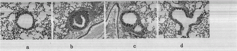 A composition for treating allergic asthma and its preparation method