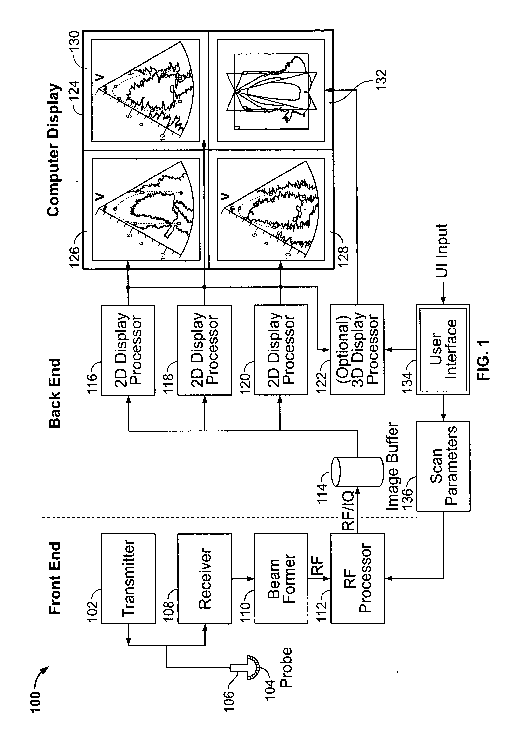 Methods and apparatus for visualization of quantitative data on a model