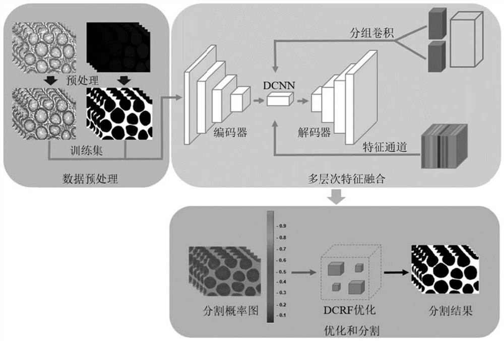 A Glandular Cell Segmentation Method Based on Multi-level Feature Fusion Network