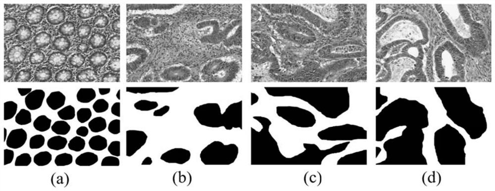 A Glandular Cell Segmentation Method Based on Multi-level Feature Fusion Network