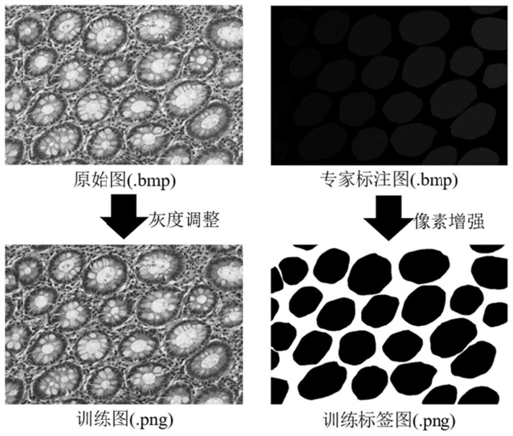 A Glandular Cell Segmentation Method Based on Multi-level Feature Fusion Network