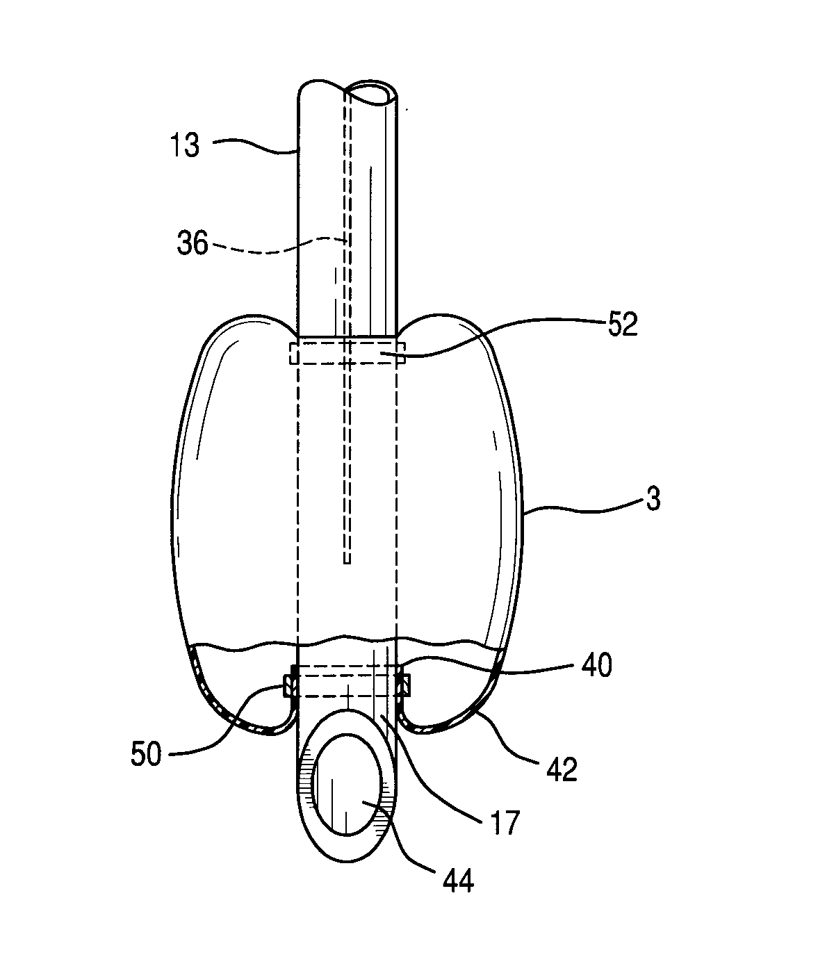 Kink resistant endotrachael tube