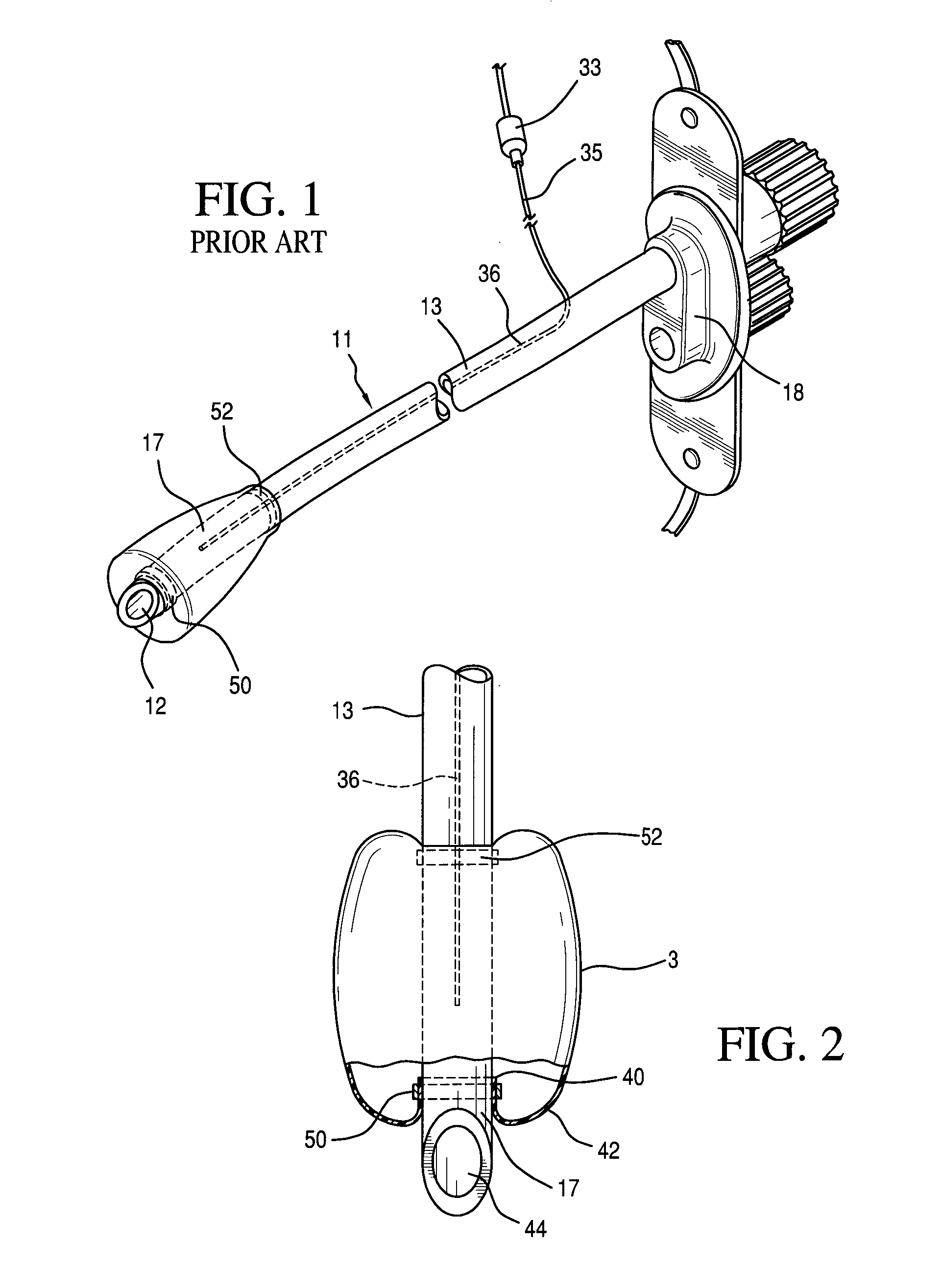 Kink resistant endotrachael tube