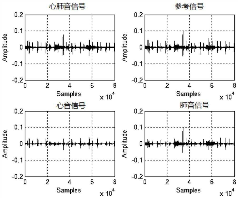 Cardiopulmonary sound signal classification method, detection method, device, medium and computer equipment