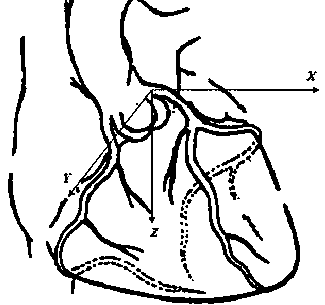 Cardiac CT image-based coronary artery calcified plaque automatic detection method