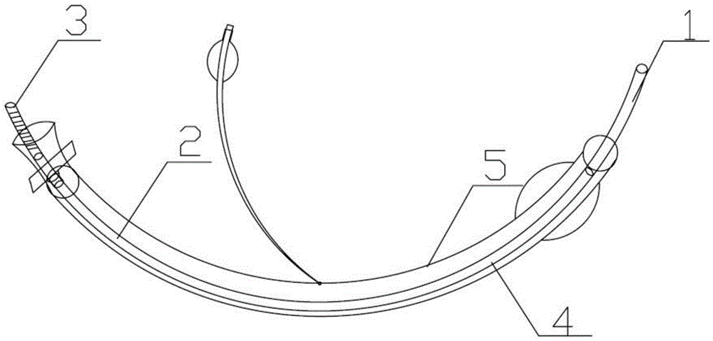 Trachea cannula core and preparation method thereof