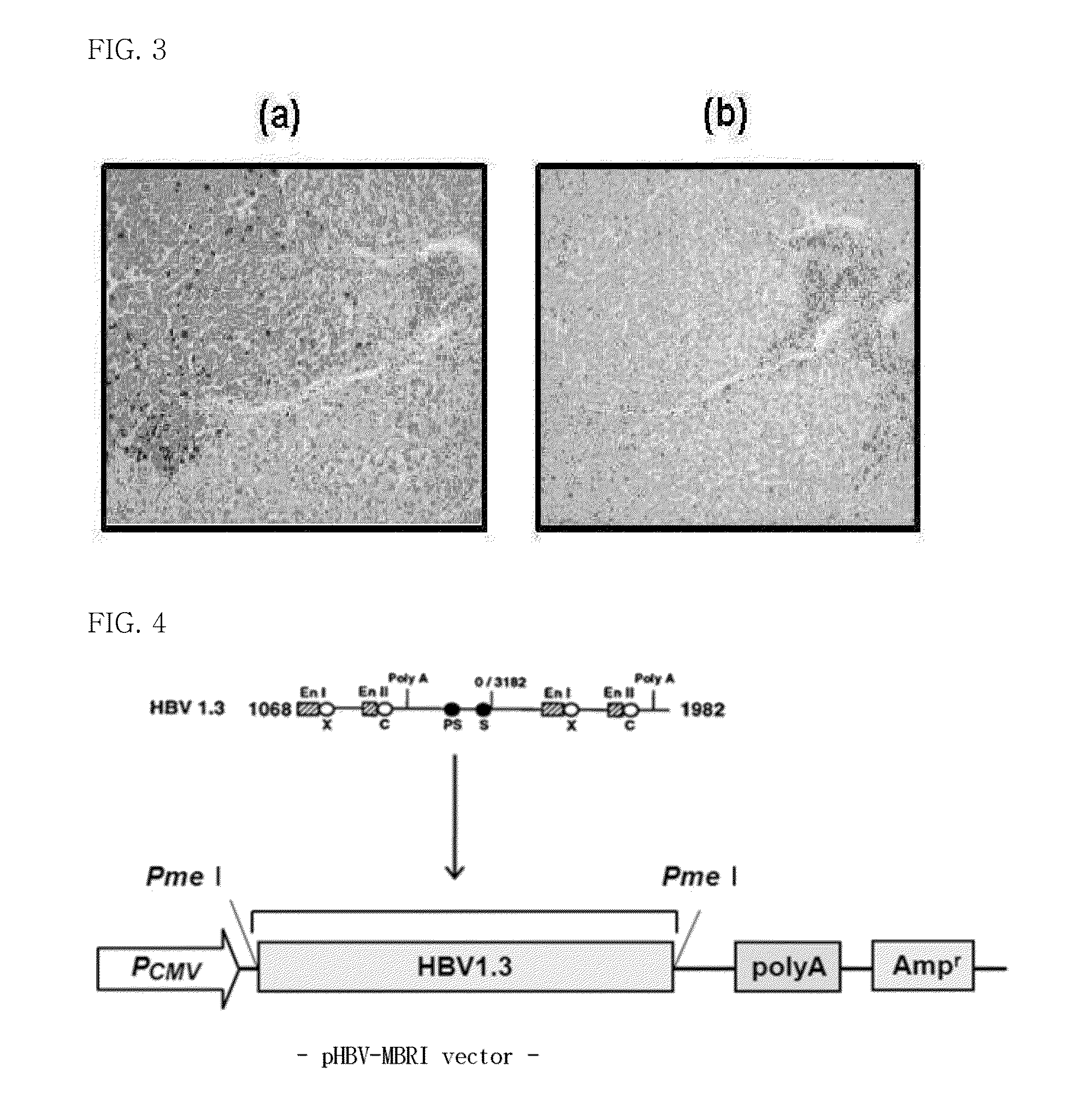 Antibody composition for prevention or treatment of mutant hepatitis b virus infection