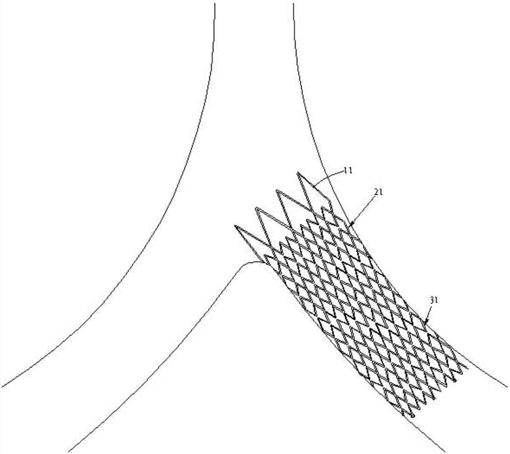 A kind of vascular stent, its preparation method and application