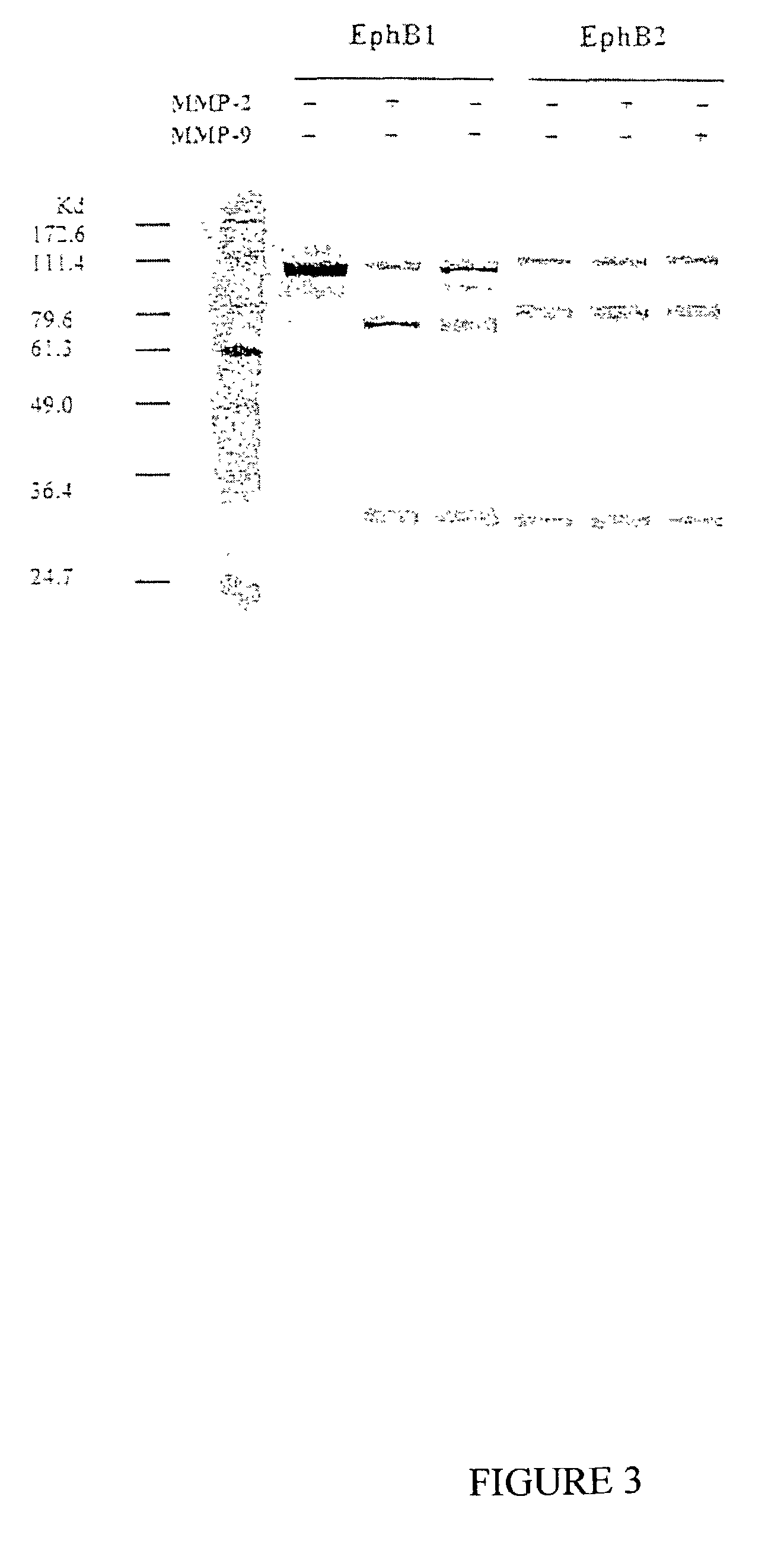 Selective substrates for matrix metalloproteinases