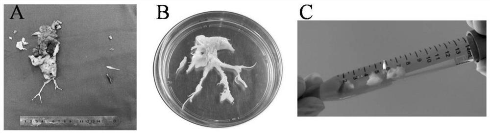 Preparation method and application of pulmonary artery tissue unicellular suspension