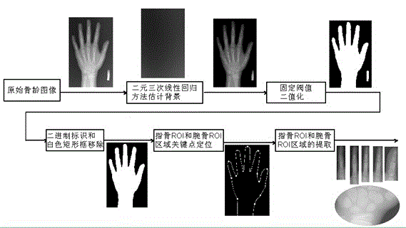 Method for preprocessing robust skeletal age evaluation image and positioning skeletal key point