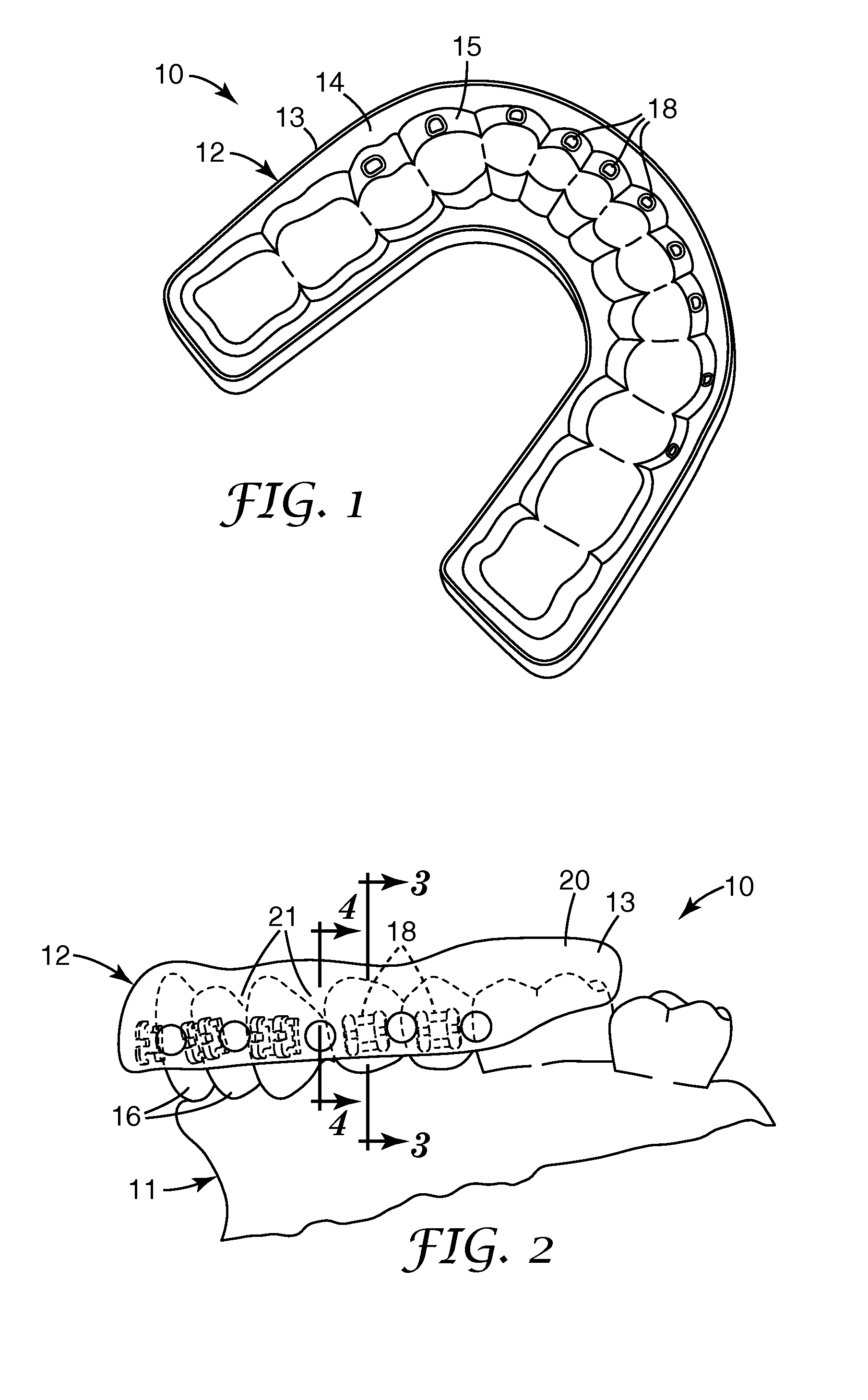 Methods and apparatus for bonding orthodontic appliances using photocurable adhesive material