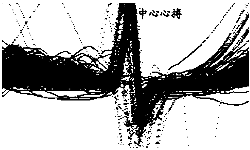 Electrocardio data analysis method and device, electrocardio analysis meter and storage medium