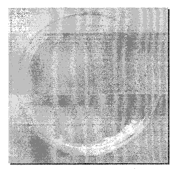 Preparation method for I/II collagen double-layer composite collagen membrane