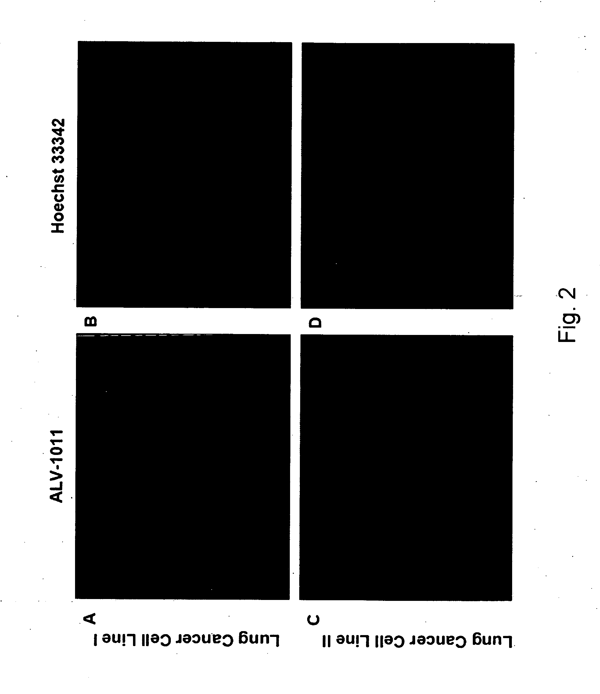 Methods and applications of molecular beacon imaging for infectious disease and cancer detection