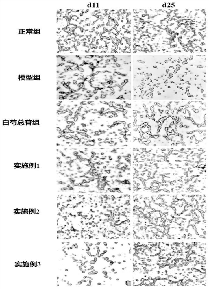 Novel Chinese herbal compound for preventing and treating sjogren syndrome and preparation method and application thereof