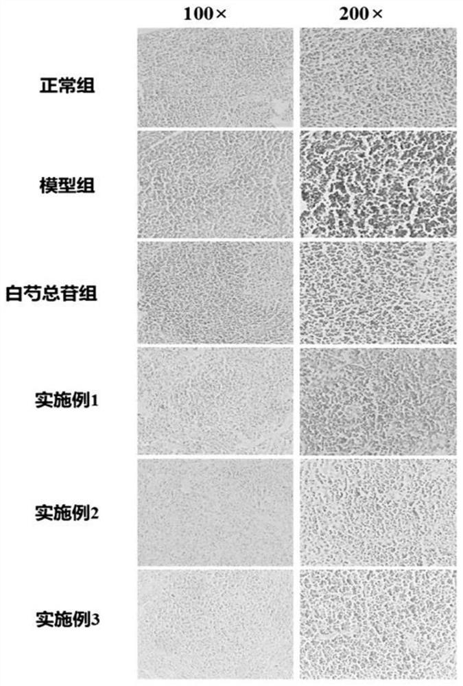 Novel Chinese herbal compound for preventing and treating sjogren syndrome and preparation method and application thereof