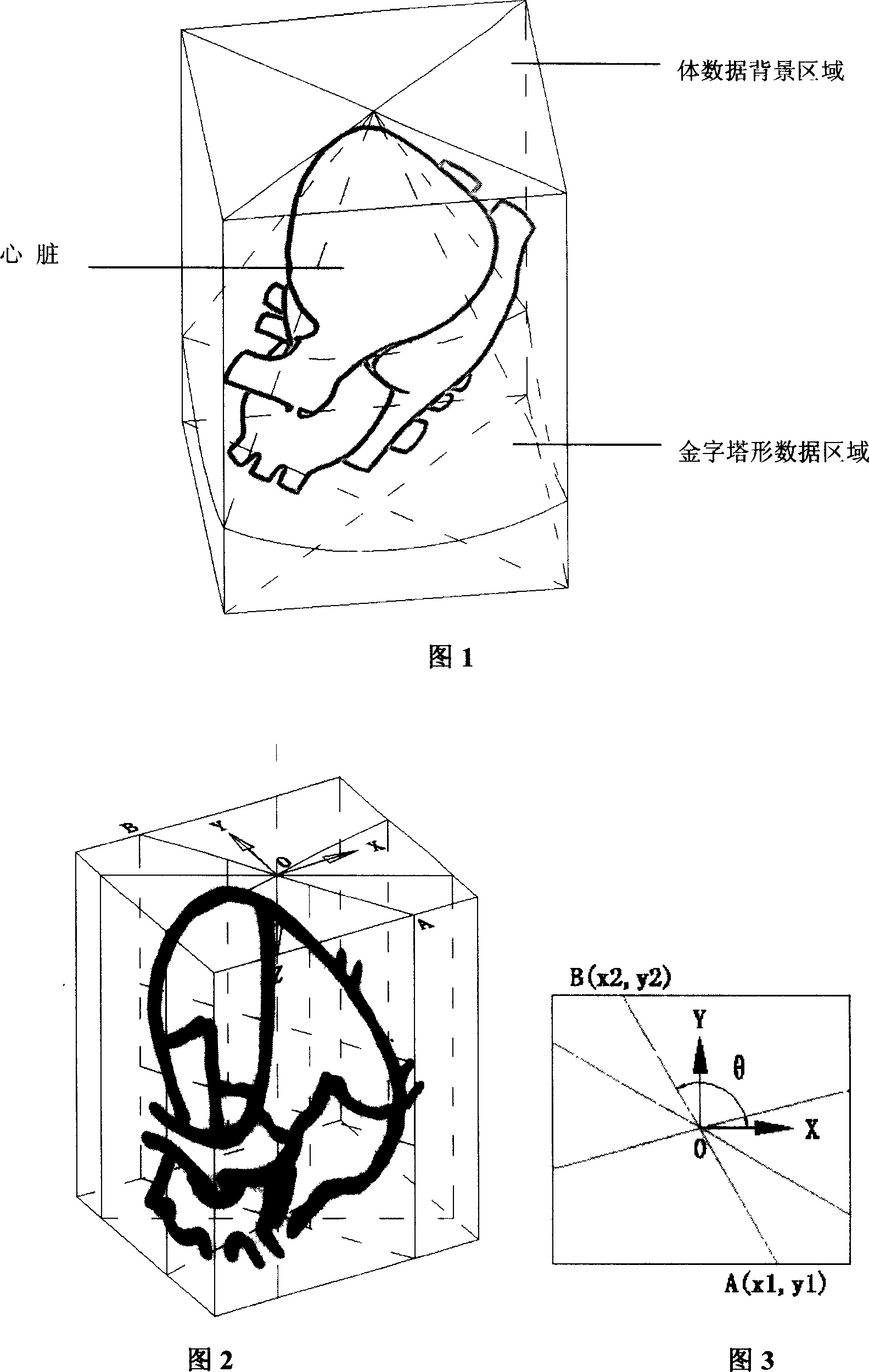 Three-dimensional ultrasound cardiogram four-cavity section image automatic detection method