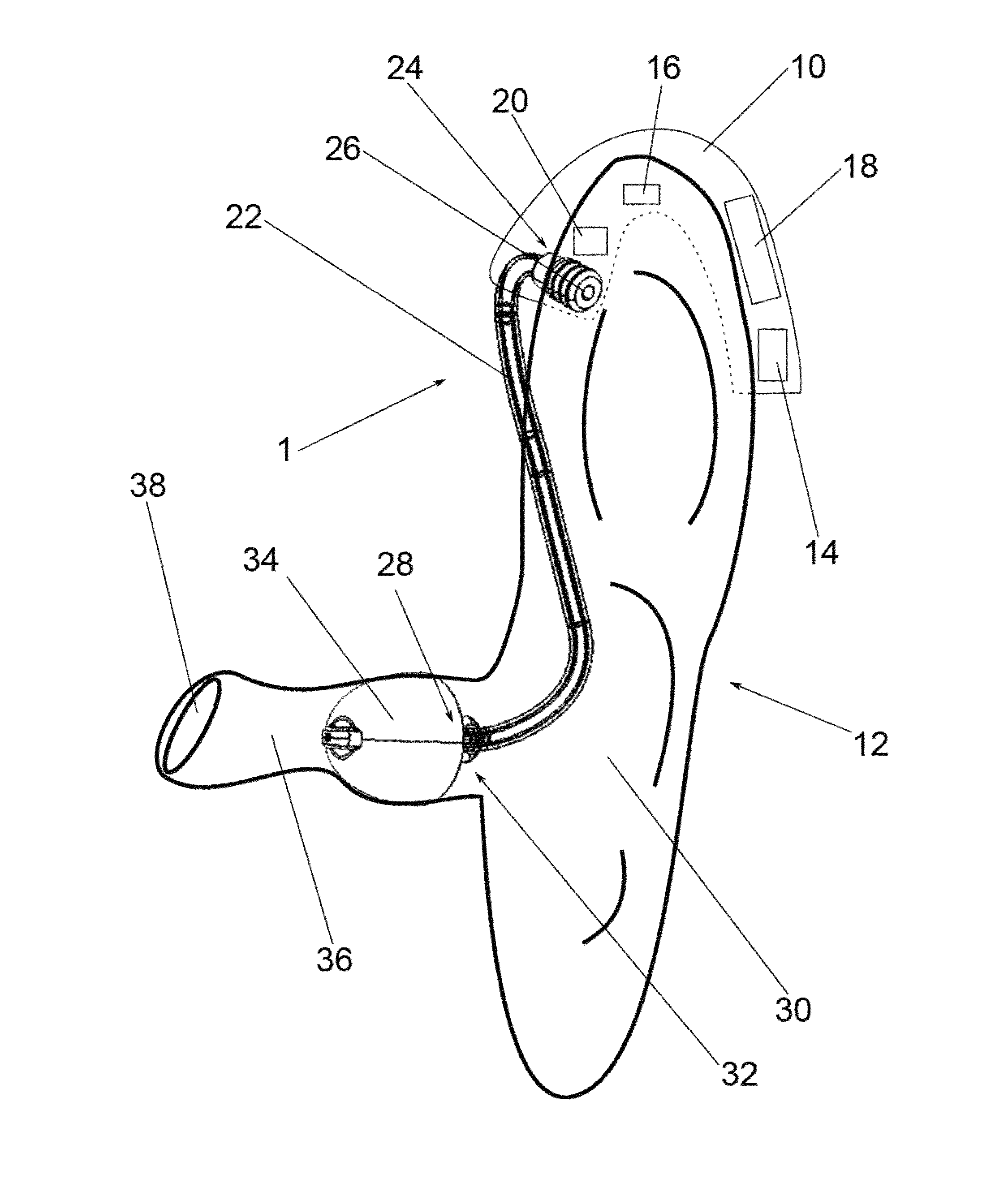 Vented dome