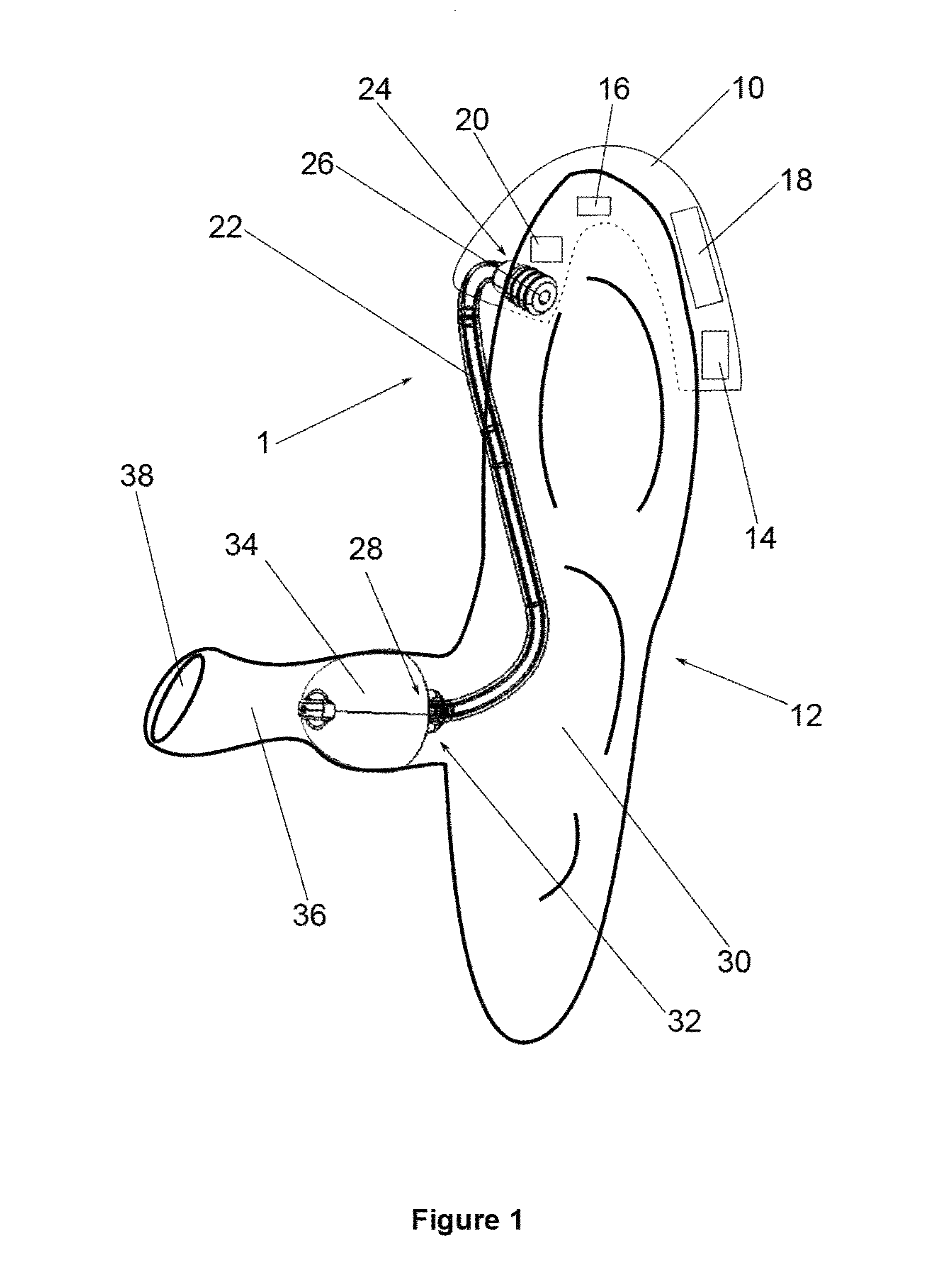 Vented dome