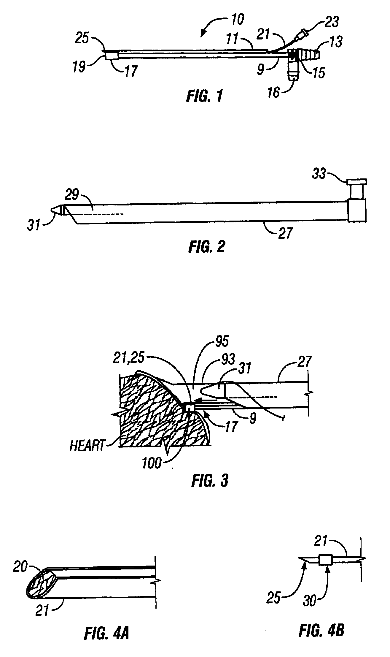 Endoscopic Cardiac Surgery