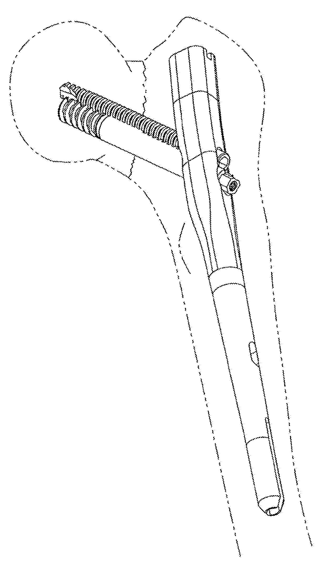 Orthopaedic implant and fastener assembly