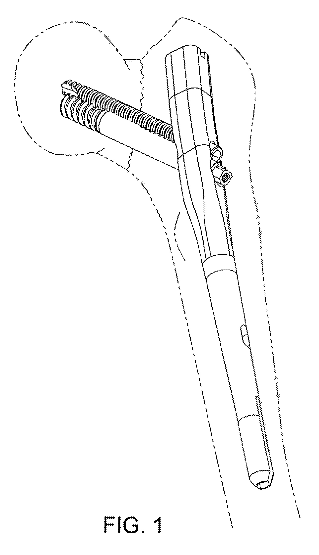 Orthopaedic implant and fastener assembly