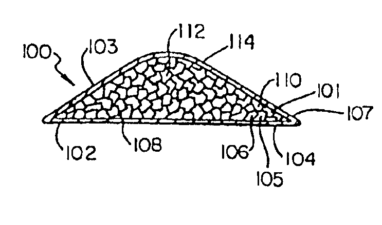 Biodegradable drug delivery vascular stent