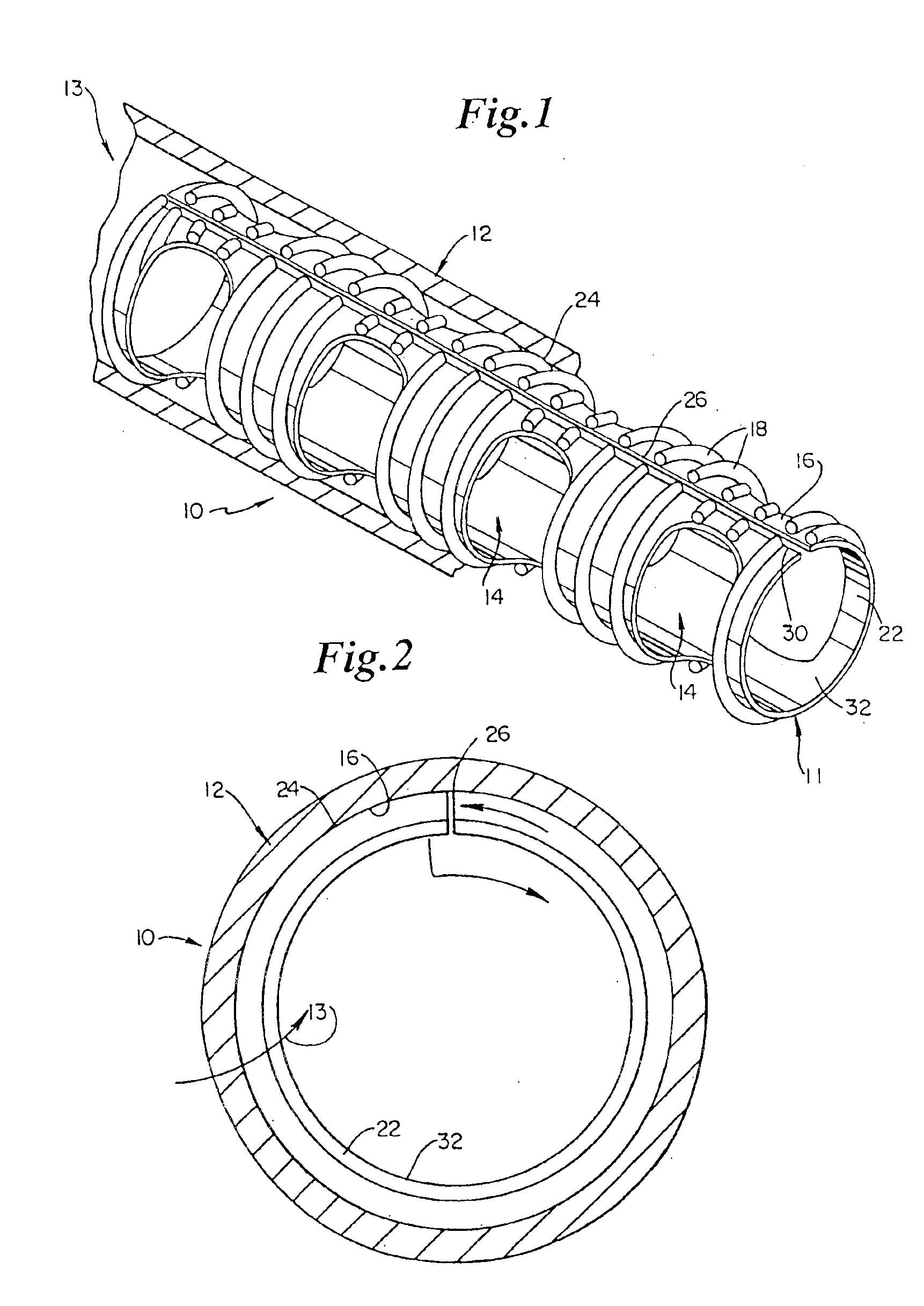 Biodegradable drug delivery vascular stent