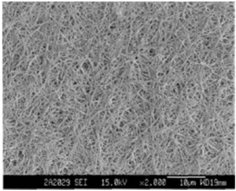 Preparation method for guided tissue regeneration membrane for periodontitis repair