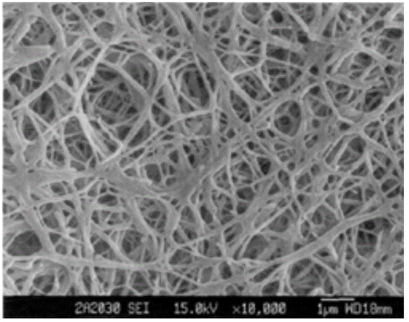 Preparation method for guided tissue regeneration membrane for periodontitis repair