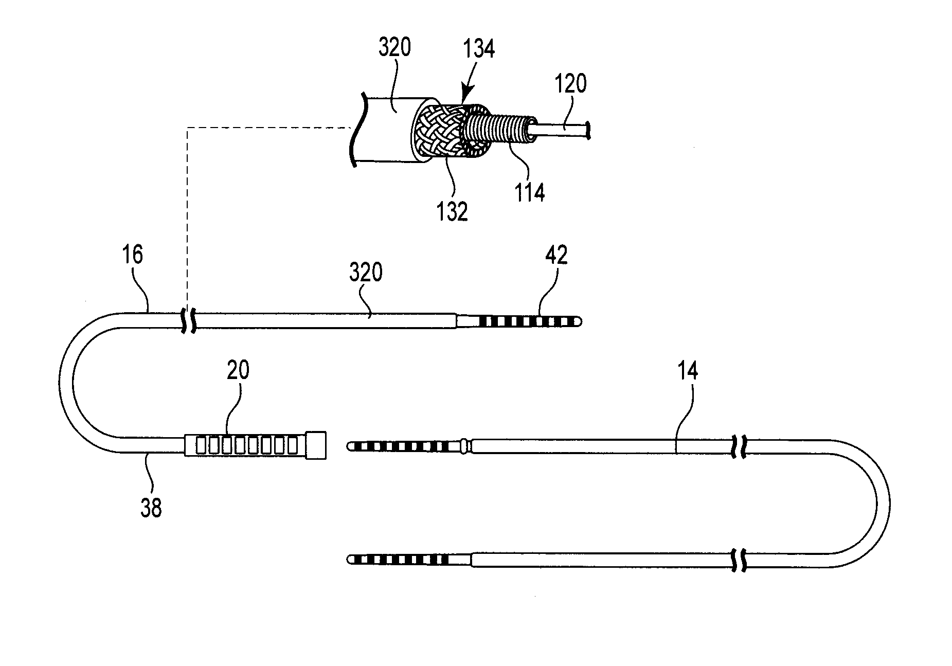 Implantable lead with braided conductors