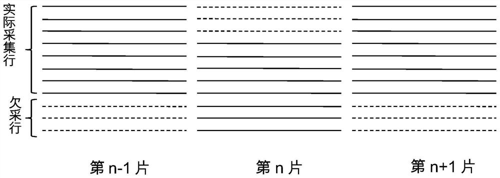 Accelerated scanning method and system of MRI system