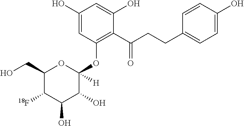 Inhibitor probes for imaging sodium-glucose cotransporters in health and disease