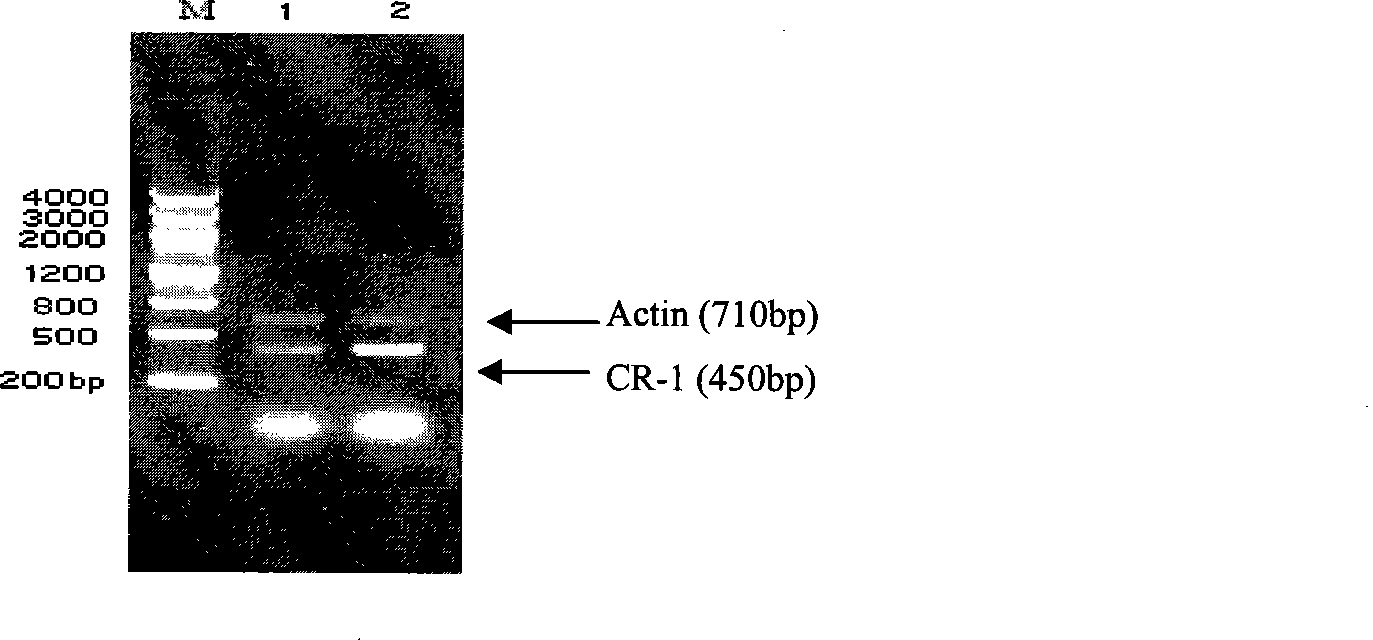 Use of CR-1 siRNA in treating myocardial hypertrophy induced by AngII