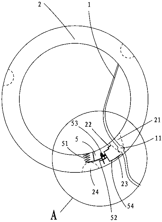 Cow left displaced abomasum operation restoration device