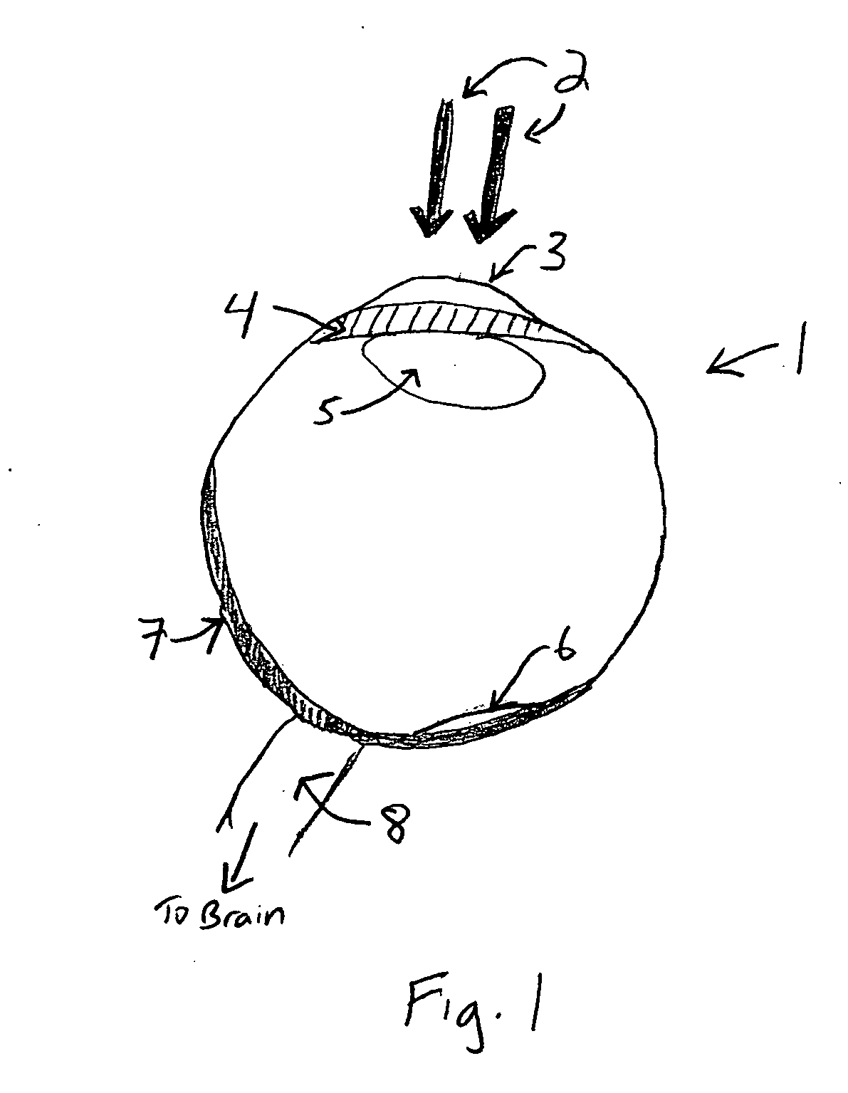 Method for correcting vision problems